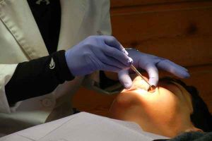 Kiedy implanty stomatologiczne to konieczność?